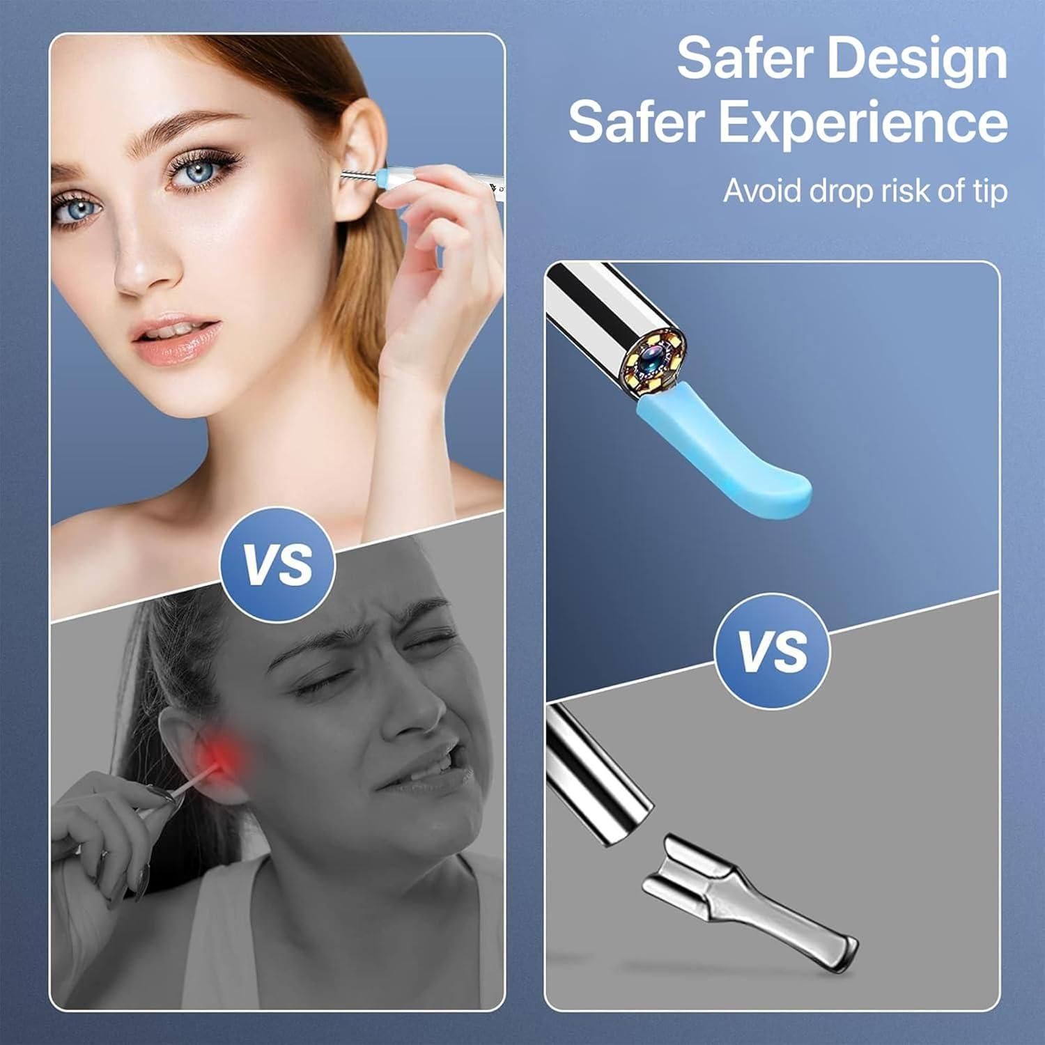 Ear Cleaner Tool with HD Camera & LED Light – Smart Otoscope Kit